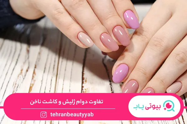 تفاوت کاشت و ژلیش ناخن