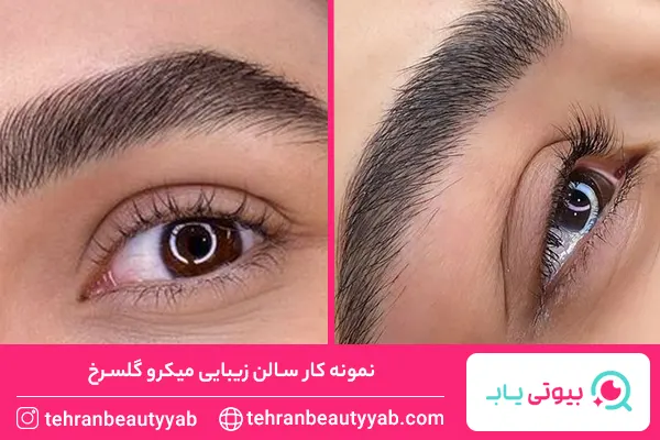 بهترین میکروبلیدینگ کار در تهرانپارس