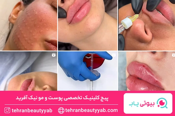 پاکسازی پوست تهرانپارس