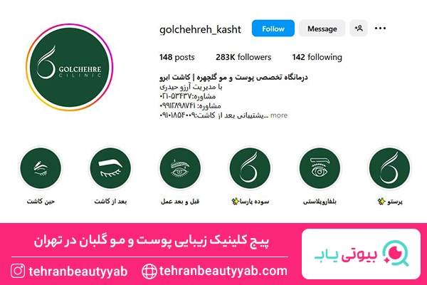 بهترین کلینیک کاشت ابرو در تهران