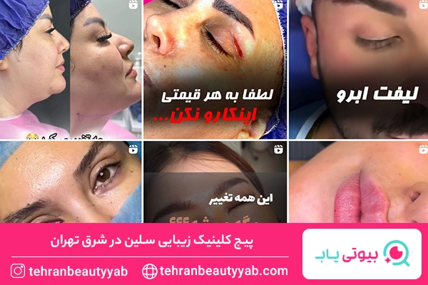 کلینیک زیبایی در شرق تهران