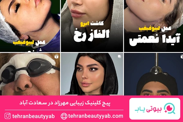 کلینیک کاشت مو سعادت اباد