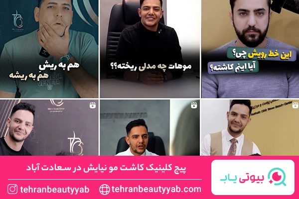 کلینیک کاشت مو سعادت اباد