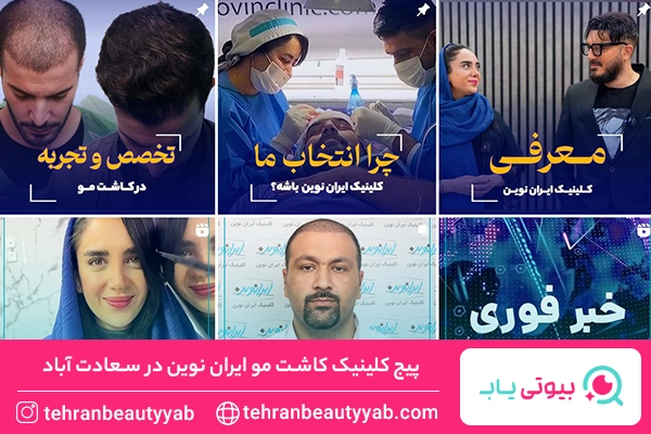 کلینیک کاشت مو سعادت اباد