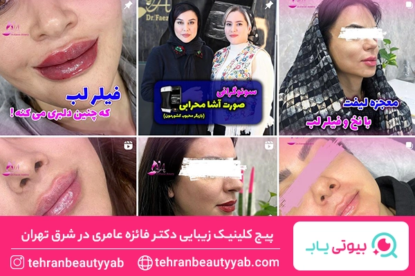 بهترین مرکز لیزر شرق تهران