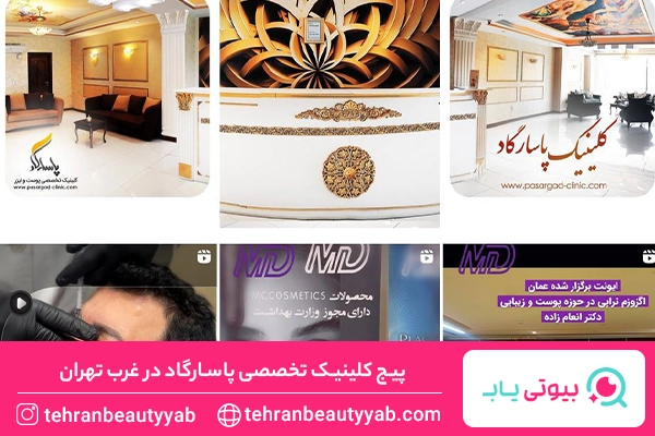 بهترین مرکز کاشت مو در غرب تهران