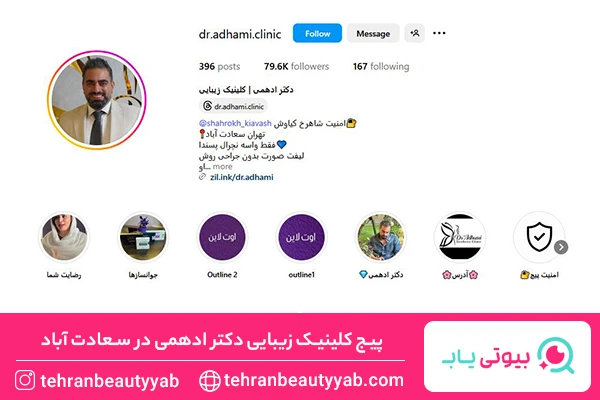 لیفت با نخ در سعادت آباد