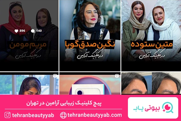 بهترین مرکز بوتاکس در تهران