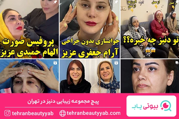 بهترین کلینیک لیفت با نخ تهران