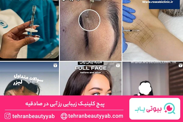 بهترین مرکز بوتاکس در صادقیه