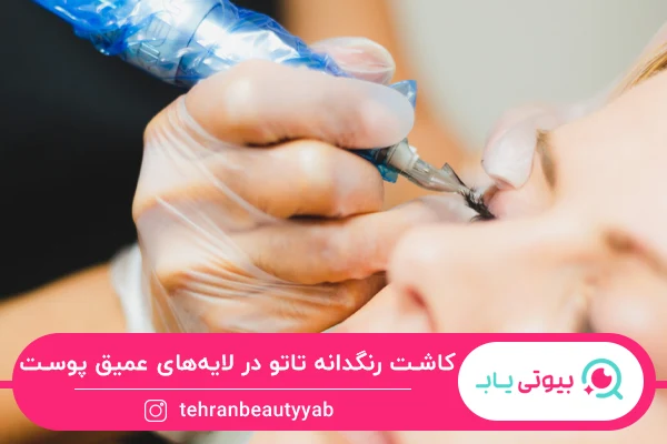 علت آبی شدن تاتو خط چشم
