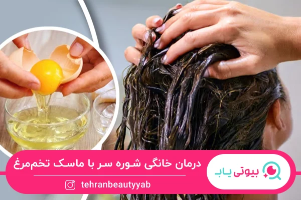 انواع روش های درمان خانگی شوره سر
