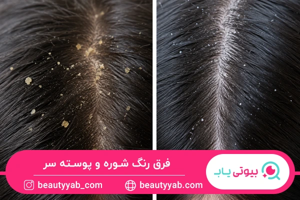 تفاوت در رنگ پوسته‌ها