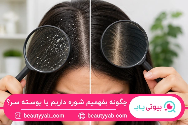 شوره داریم یا خشکی پوست سر؟