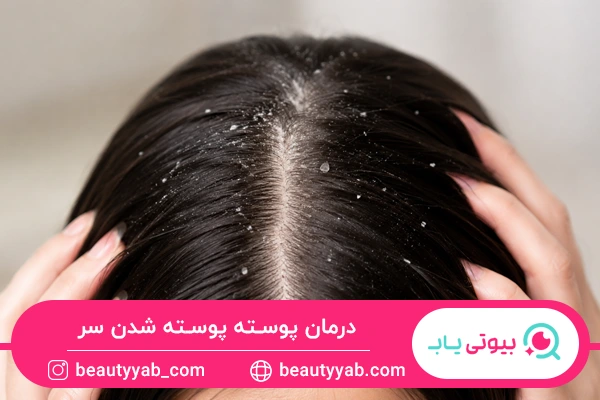 درمان پوسته پوسته شدن سر