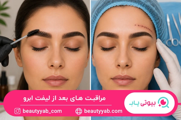 مراقبت های بعد از لیفت ابرو