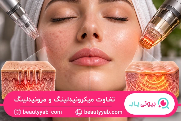 تفاوت تعداد جلسات میکرونیدلینگ و مزونیدلینگ