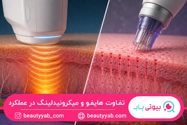 تفاوت هایفو و میکرونیدلینگ در نحوه عملکرد