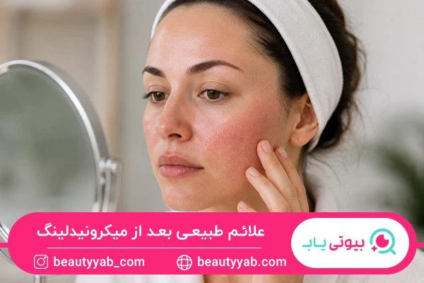 علائم طبیعی بعد از میکرونیدلینگ