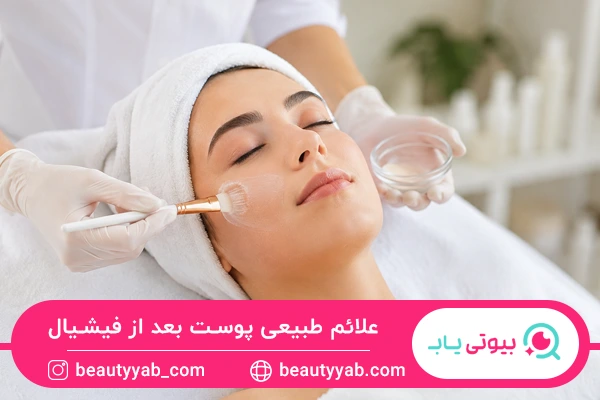 علائم طبیعی پوست بعد از فیشیال