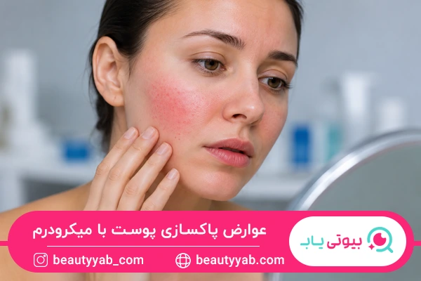 عوارض پاکسازی پوست با میکرودرم