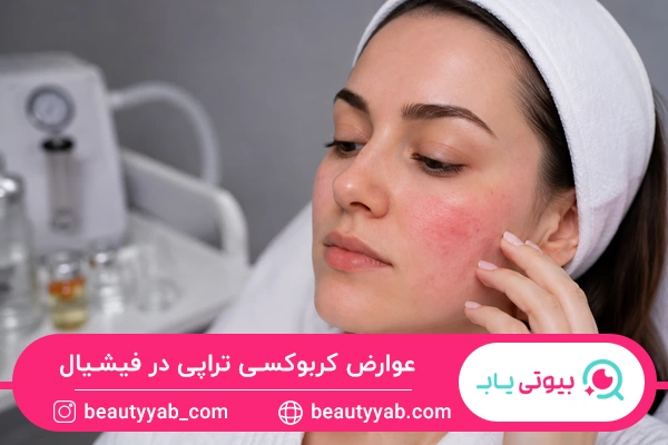 عوارض کربوکسی تراپی در فیشیال
