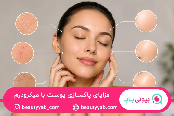 مزایای پاکسازی پوست با میکرودرم