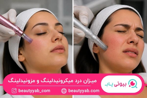 میزان درد میکرونیدلینگ و مزونیدلینگ