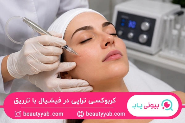 کربوکسی تراپی در فیشیال با تزریق