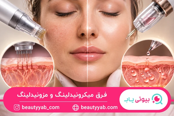 فرق میکرونیدلینگ و مزونیدلینگ