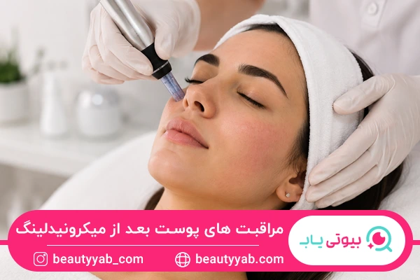 مراقبت های پوست بعد از میکرونیدلینگ