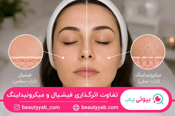 تفاوت عمق اثر فیشیال و میکرونیدلینگ روی پوست