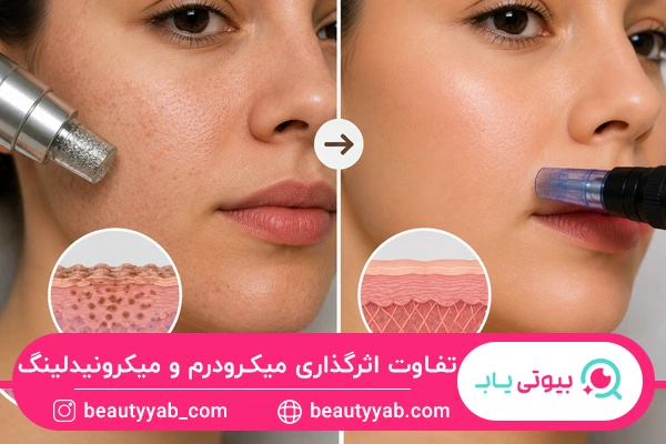 تفاوت میکرودرم و میکرونیدلینگ از نظر میزان اثرگذاری