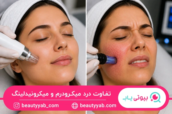 تفاوت درد میکرودرم و میکرونیدلینگ