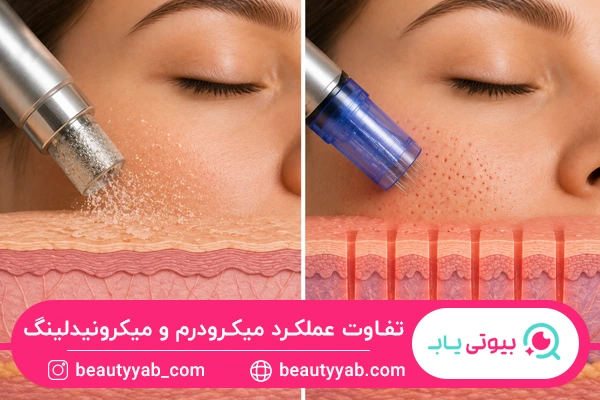 تفاوت میکرودرم و میکرونیدلینگ در نحوه عملکرد