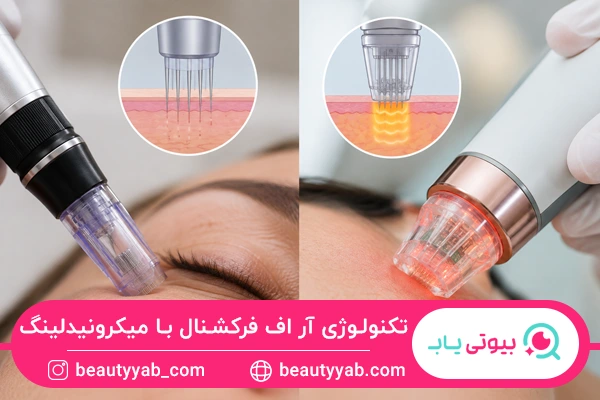 تفاوت تکنولوژی آر اف فرکشنال و میکرونیدلینگ