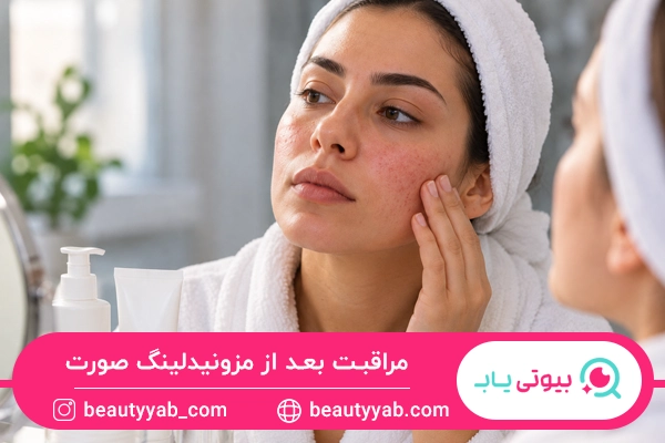 نکات مهم بعد از مزونیدلینگ صورت