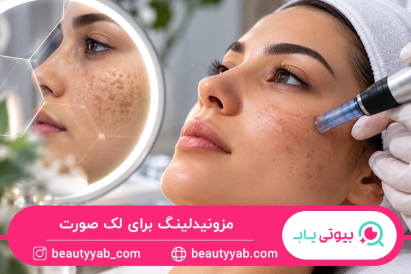 مزونیدلینگ برای لک صورت
