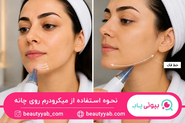نحوه استفاده از میکرودرم روی چانه و خط فک
