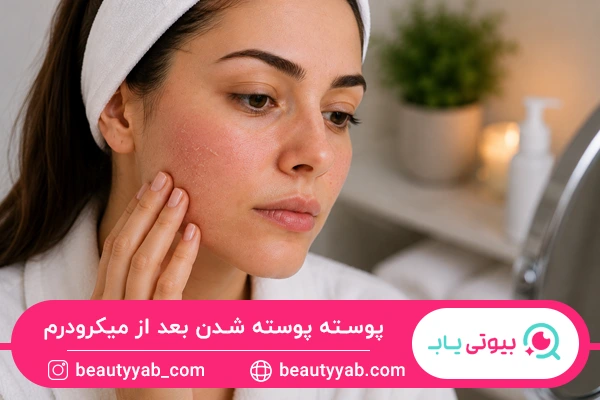 پوسته پوسته شدن بعد از میکرودرم