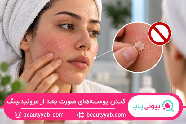 کندن پوسته‌های صورت بعد از مزونیدلینگ