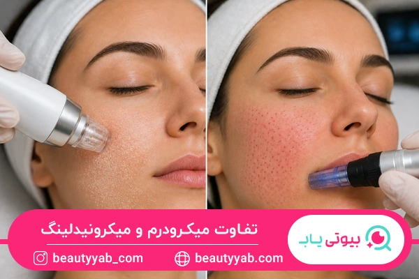 تفاوت میکرودرم و میکرونیدلینگ