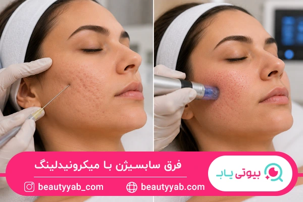 فرق سابسیژن با میکرونیدلینگ