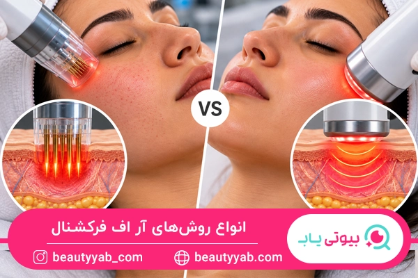انواع روش‌های آر اف فرکشنال