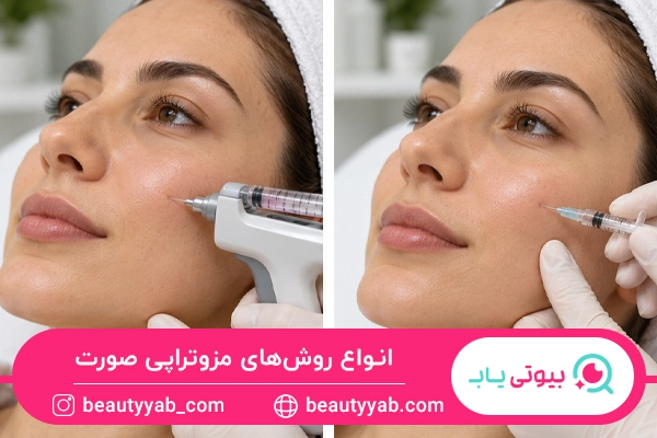 انواع روش‌های مزوتراپی صورت