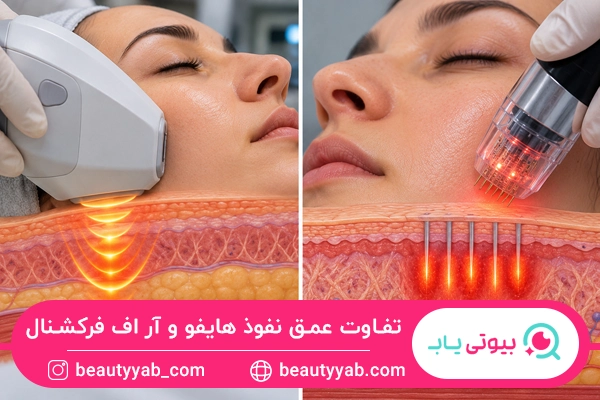 تفاوت عملکرد و عمق نفوذ هایفو و آر اف فرکشنال