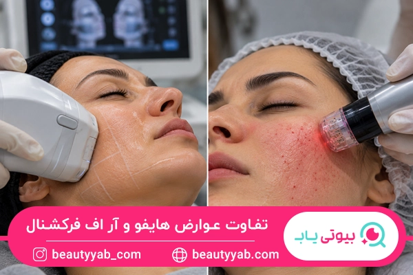 تفاوت عوارض هایفو و آر اف فرکشنال