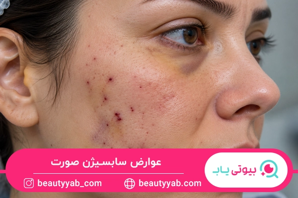 عوارض سابسیژن صورت