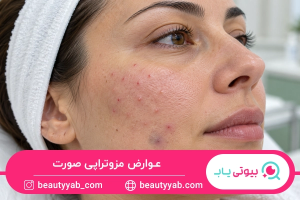 عوارض مزوتراپی صورت
