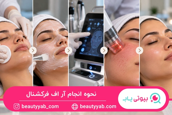 نحوه انجام آر اف فرکشنال